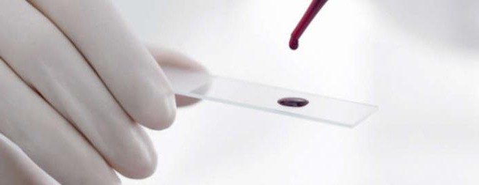 биохимический анализ крови расшифровка алт аст