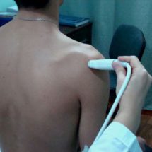 Ультразвуковое исследование (УЗИ) плечевого сустава