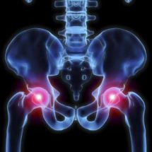 Ультразвуковое исследование (УЗИ) тазобедренного сустава у взрослых