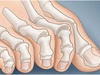 Пальцы ноги